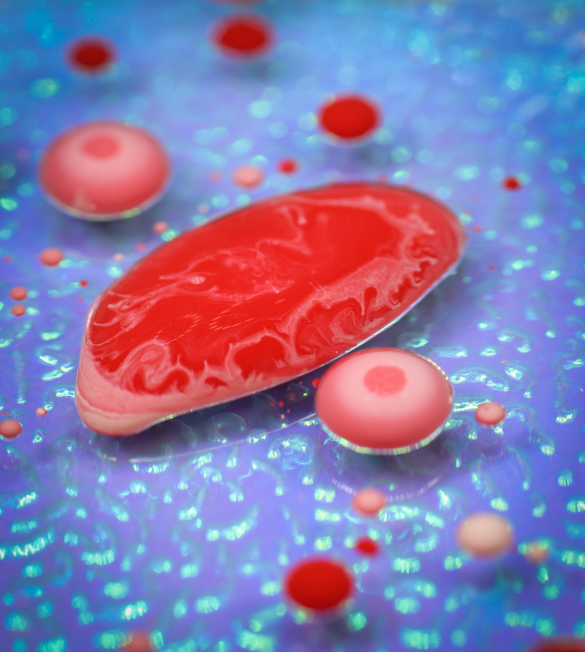 High Cholesterol